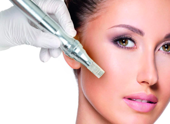 Microneedling